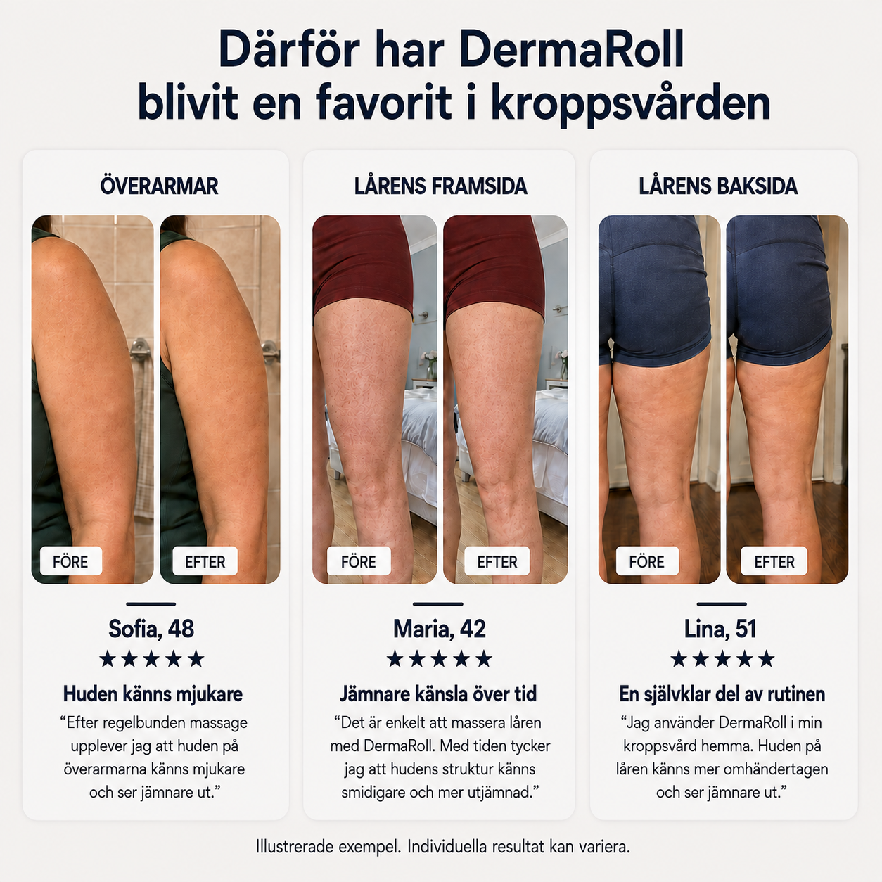 DermaRoll™ Elektrisk Massageroller för Celluliter & Muskelmassage