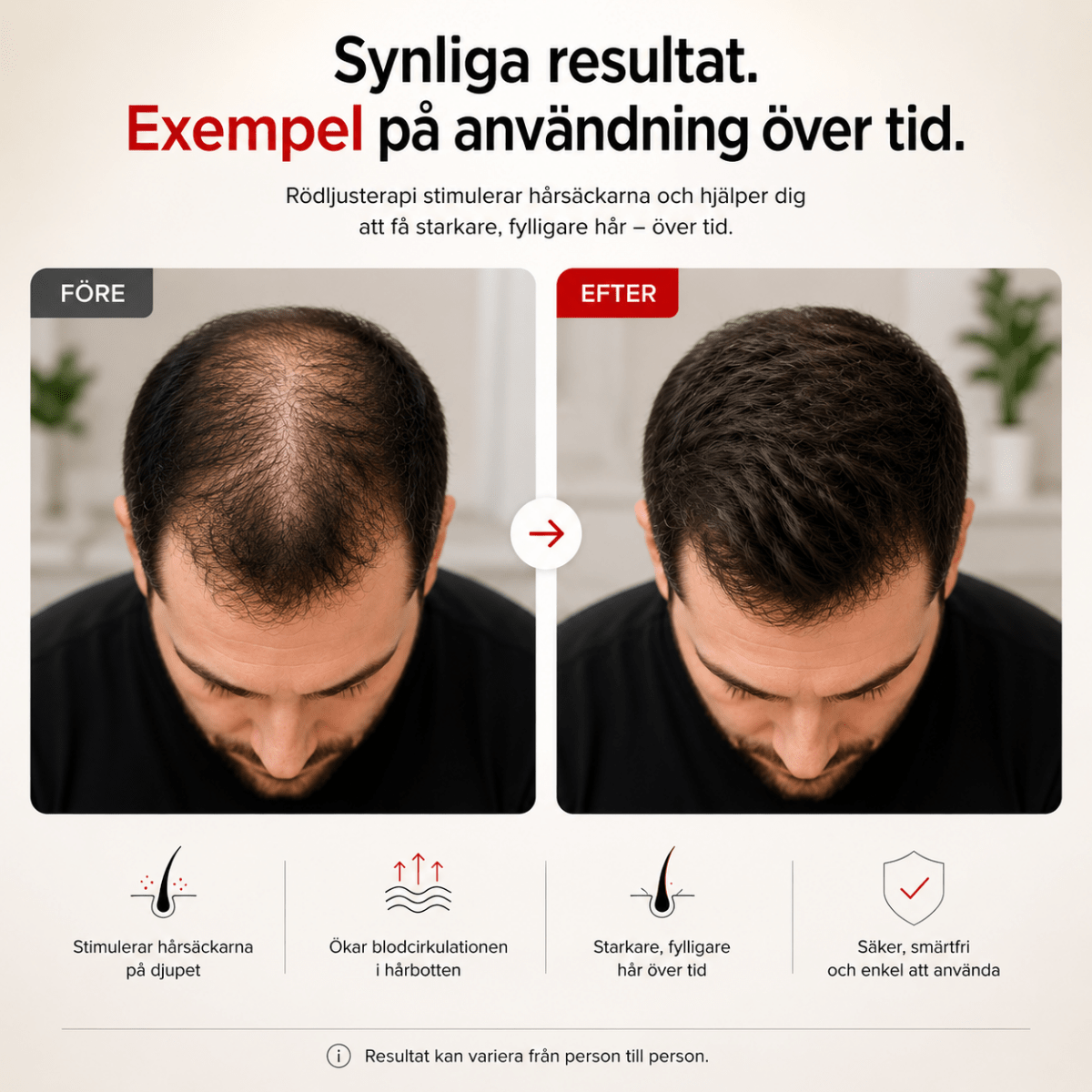 Före och efter rödljusterapi för hårbotten
